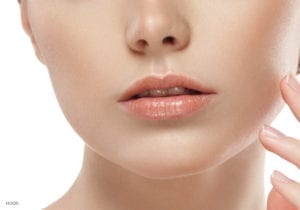 Ocala Female With Smooth Chin After Kybella Injection
